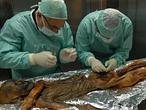 Ötzi, el «hombre de hielo», sufría del corazón y tiene «parientes» vivos