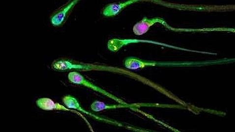 la próstata puede afectar el esperma