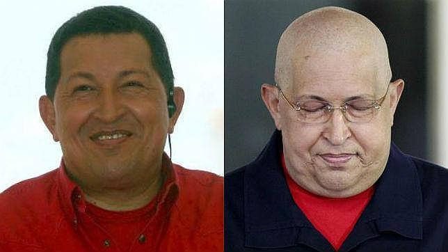 «Una inyección habría sido suficiente para inocular el cáncer a Chávez»