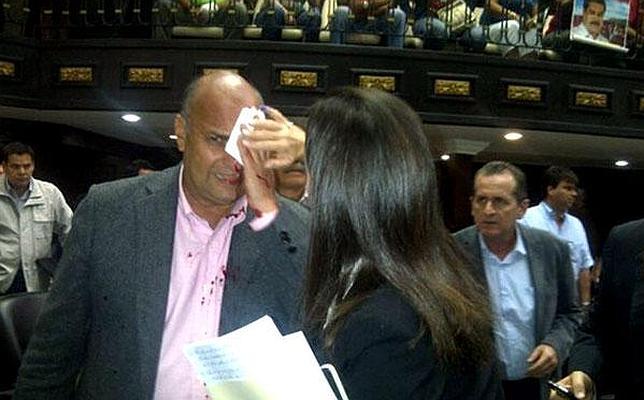 El diputado opositor William Dávila fue brutalmente agredido