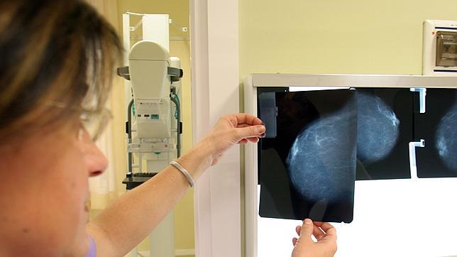 El colesterol alto favorece el crecimiento y la dispersión del cáncer de mama