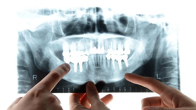 Las consecuencias de una mala salud bucodental van mucho más allá la estética