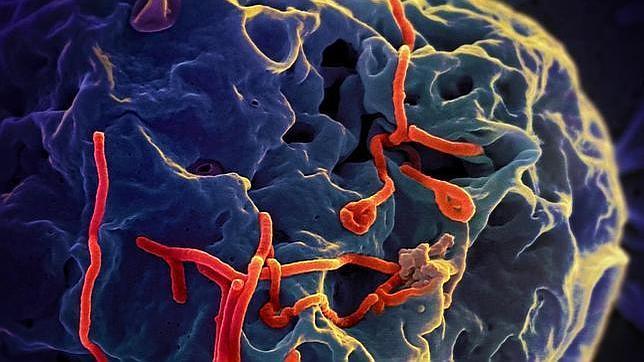 Según algunos investigadores, harían falta cientos de miles de dosis de este tratamiento contra el ébola (en la imagen, los filamentos rojos)