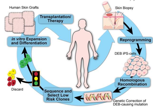 A partir de una biopsia de la piel del paciente se extraen las células que se reprogramas y se convierten en células iPS. Después de un proceso de recombinación que corrige los defectos genéticos que causan la enfermedad, las células se cultiva y vitro para posteriormente trasplantarse al mismo paciente