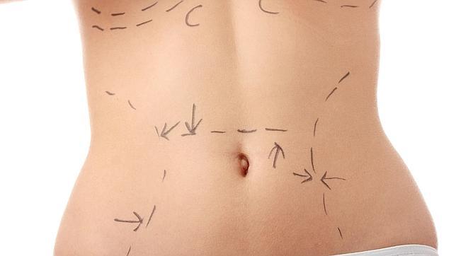 Despues embarazo distendido abdomen