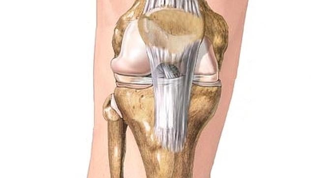 En rodilla dolor la centro el de