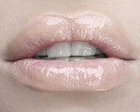 Bulto en el labio inferior boca Bulto en el labio inferior boca