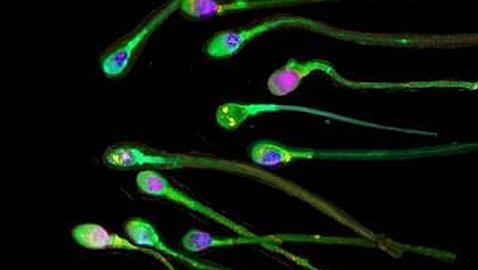 «La calidad del semen se derrumba»