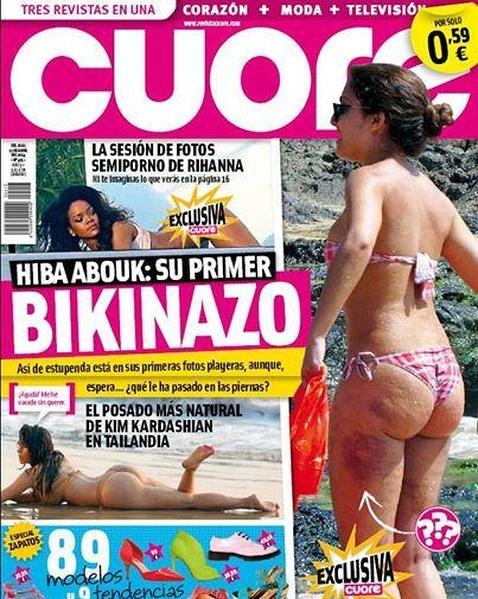 La portada de «Cuore» destaca los moratones de Hiba Abouk