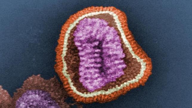 ¿Qué es un virus?