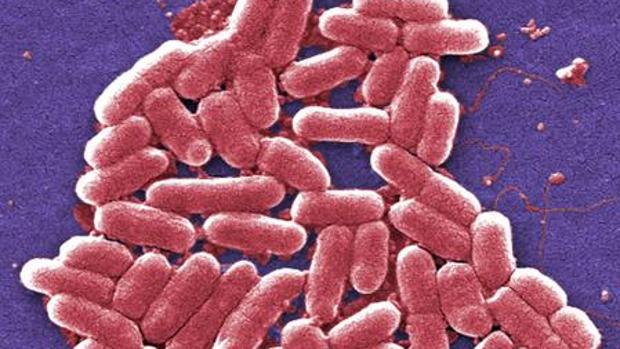 Fotografía de bacterias «Escherichia coli»