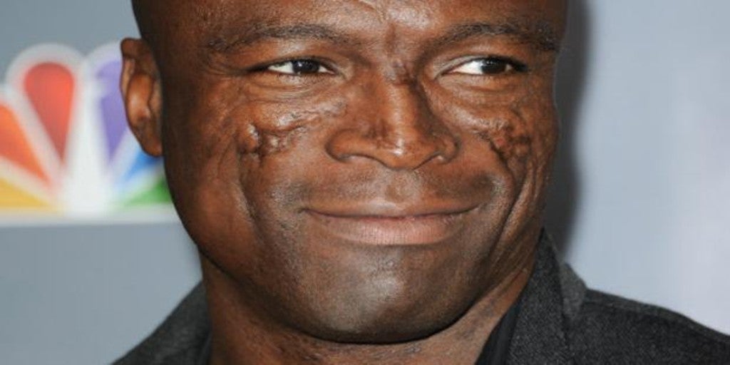 La historia de superación detrás de las impactantes cicatrices del cantante Seal