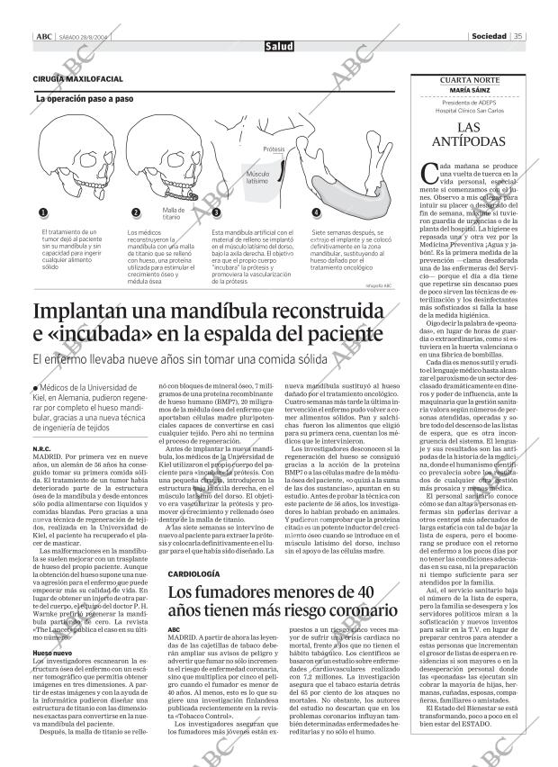 ABC MADRID 28-08-2004 página 35