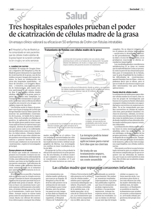 ABC MADRID 06-11-2004 página 51