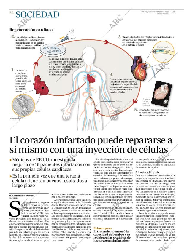 ABC MADRID 15-11-2011 página 54