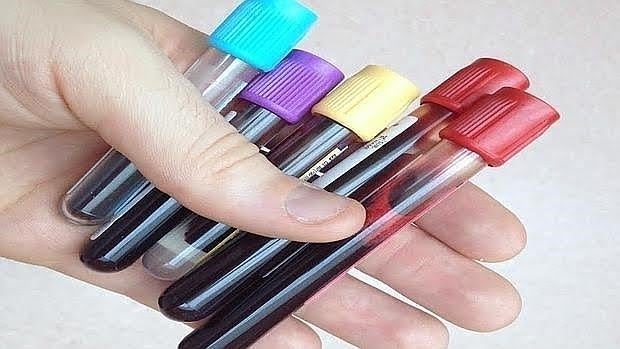que enfermedades detecta el analisis de sangre