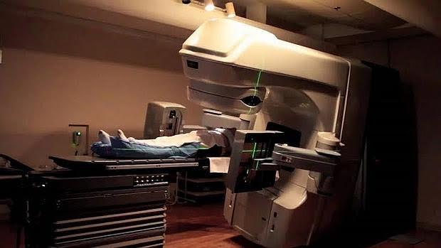 riesgos con radioterapia de próstata y alrededores