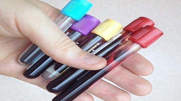 Detectar cancer con un analisis de sangre