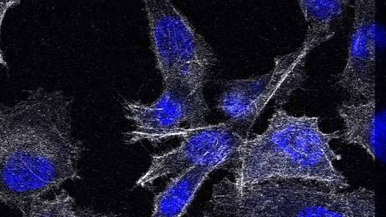 opciones de tratamiento para el cáncer de próstata en el norte de Texas