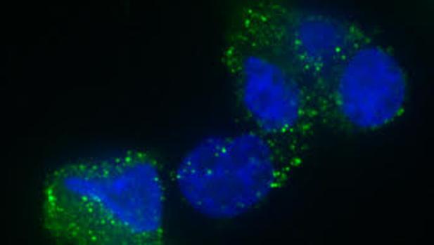 Células de glioblastoma