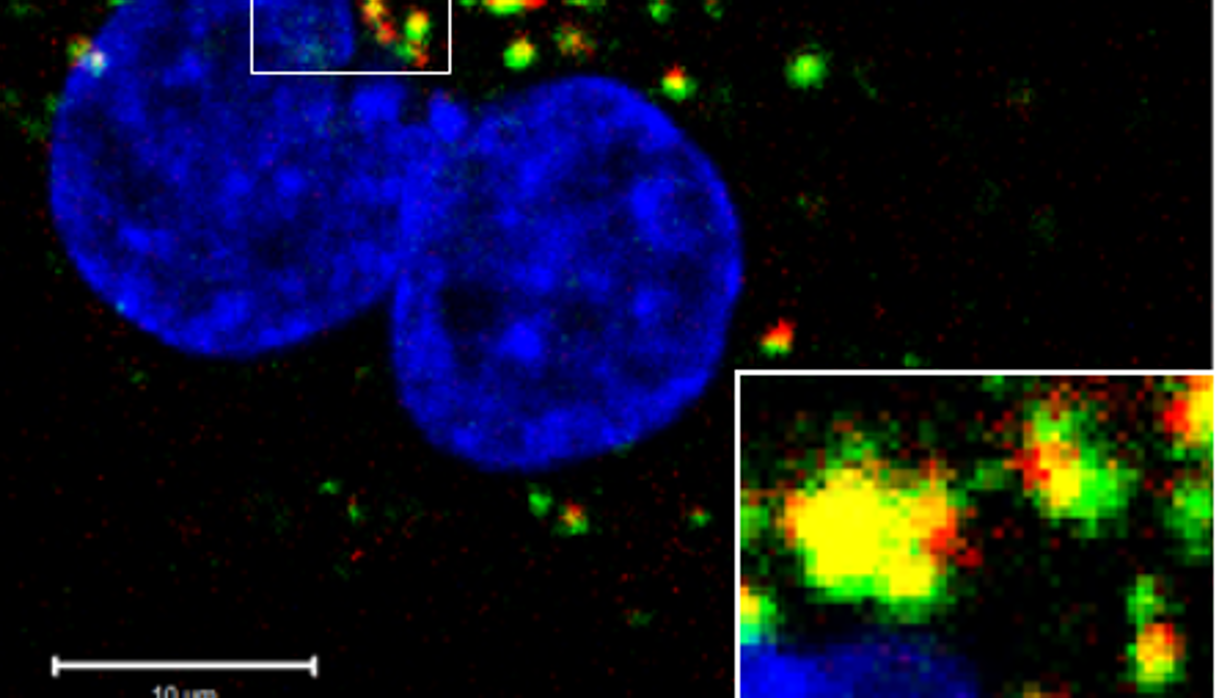células de cáncer de próstata humano para