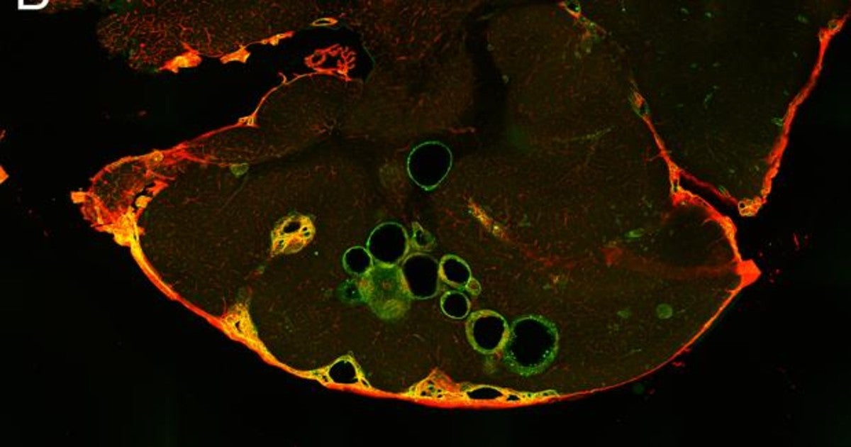 propranolol comprar españa