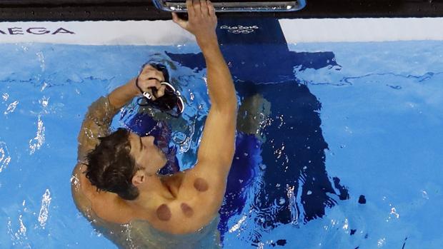 Los moratones de Michael Phelps