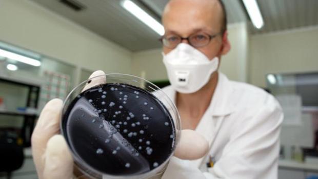 Un investigador muestra un cultivo de legionela
