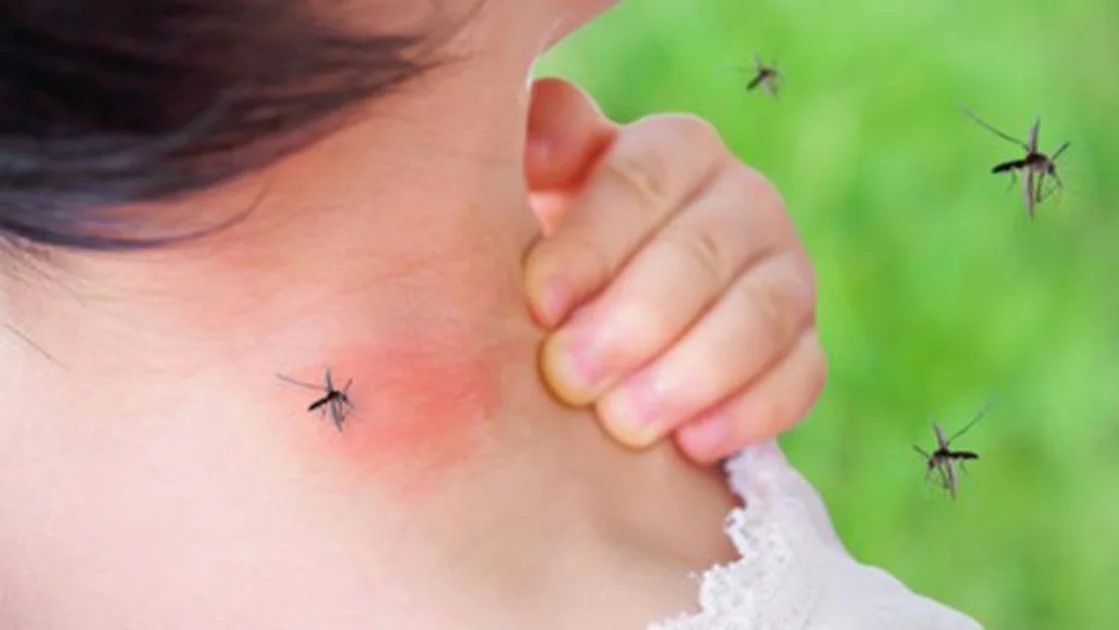 Sinfonía césped profundidad La OCU advierte que las pulseras y los aparatos ultrasonidos contra los  mosquitos no funcionan