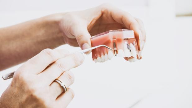 El 'boom' de los tratamientos dentales o cómo tener unos dientes perfectos ha pasado a ser tendencia